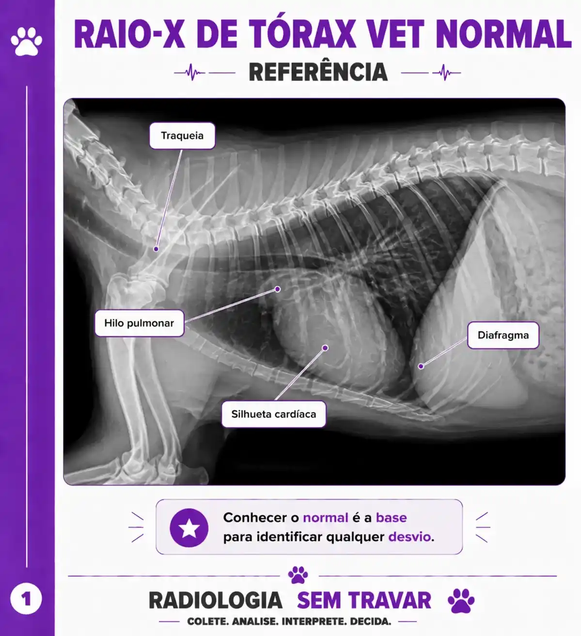 Tórax normal